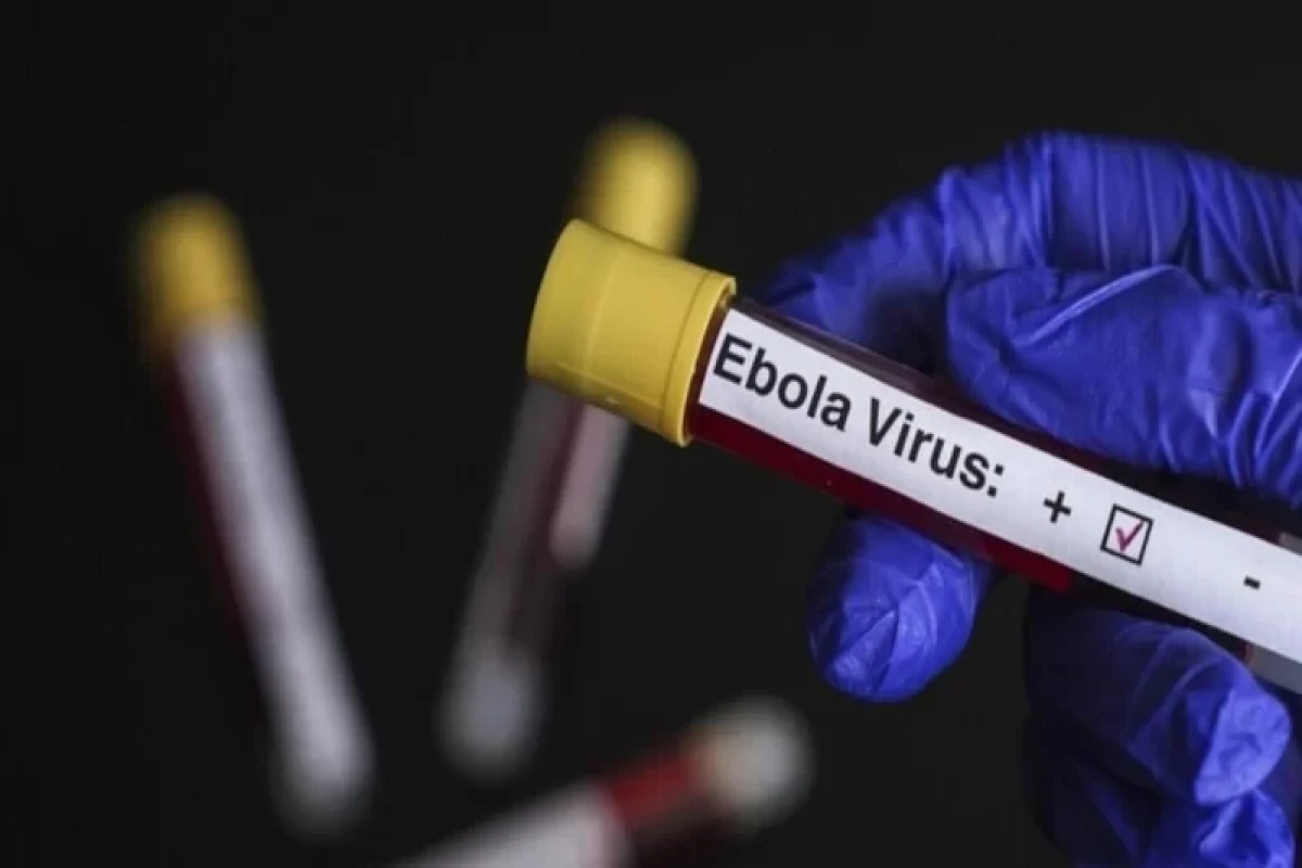 Uqandada “Ebola” virusuna qarşı yeni peyvəndin klinik sınaqlarına başlanıldı - Təzadlar - Təzadlar xəbəri üçün şəkil